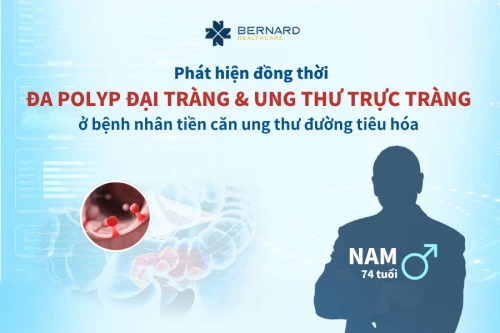 Phát hiện đồng thời đa polyp đại tràng và ung thư trực tràng ở bệnh nhân có tiền căn ung thư đường tiêu hóa